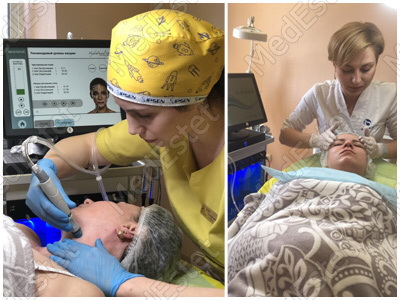hydra facial в виннице